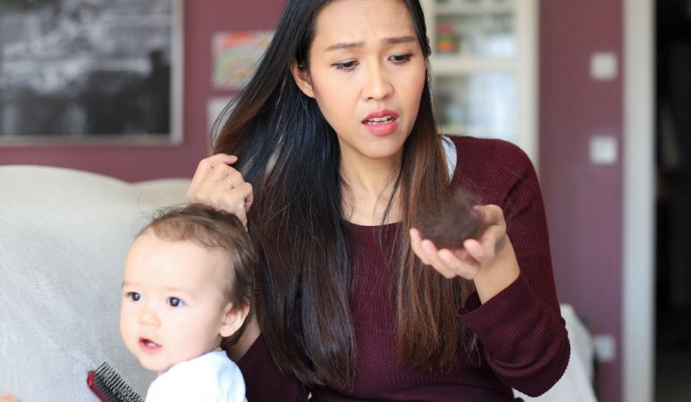 Battling Postpartum Hair Loss: How PRP Therapy Can Help Moms Regain Their Hair